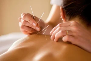 what does dry needling do