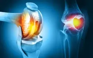 Total Joint Replacement Rehabiliation, Exercises, and Physical Therapy Guide (1)
