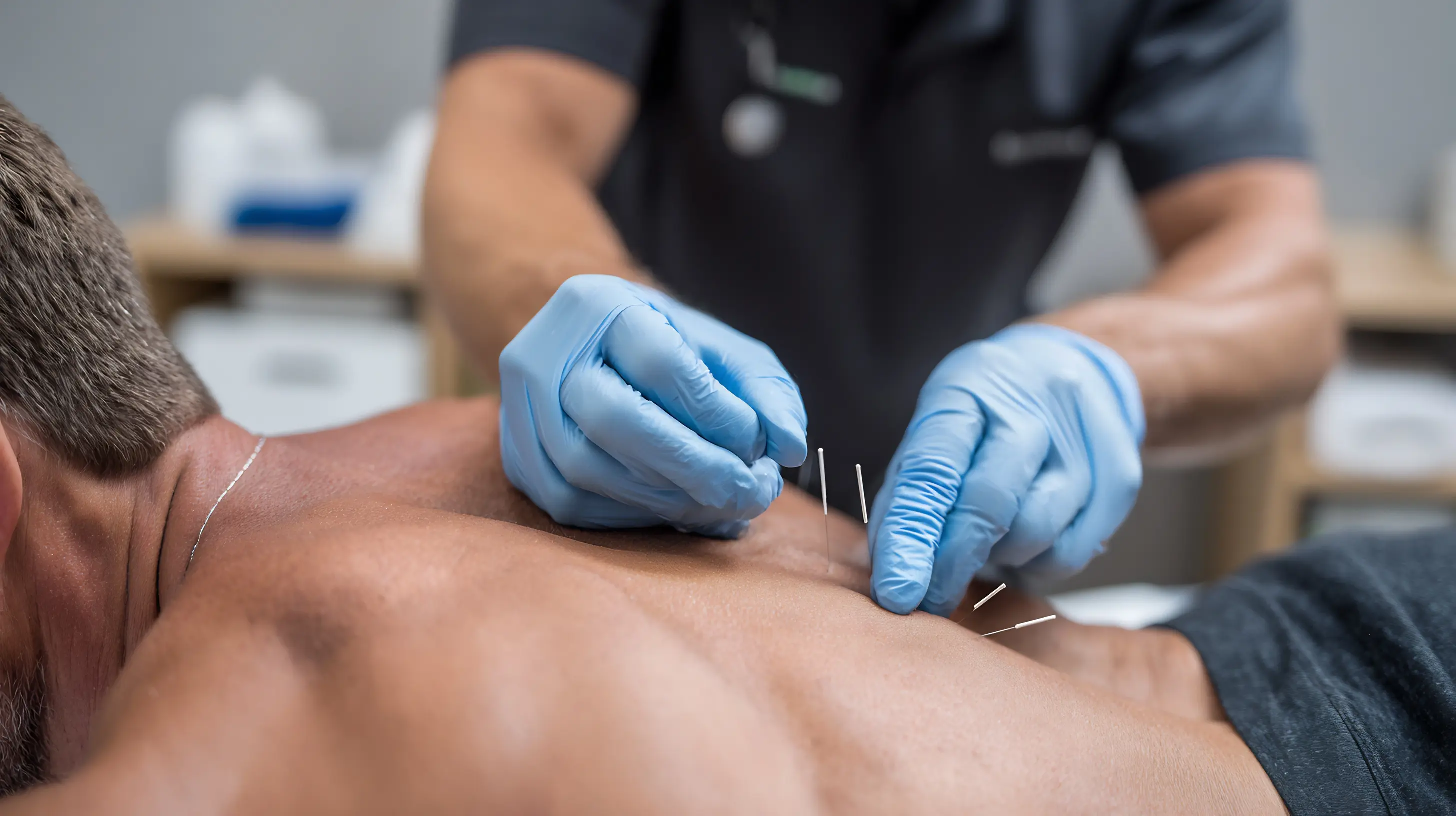 What Is Dry Needling Treatment?