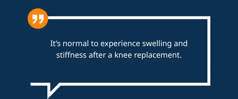 Average Timelines For Swelling And Stiffness Reduction